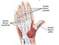 Trauma <b>tendini</b>-7.jpg