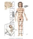 Eating Disorders: Anorexia Nervosa and Bulimia - Netter Medical ...