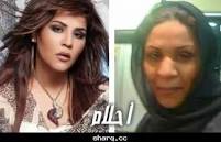 الفنانات قبل عملية التجميل ومن دون مكياج Images?q=tbn:ANd9GcRjCUaWxsnFcZmAZyPOmSnpkTtqIw-bgnMbQD720lfKFyKAzlavVR-97ODz