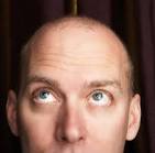 Baldness: Stem Cells May Be Responsible for Baldness | Inspiring ...