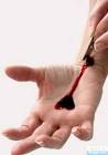Suicide and suicidal behavior photos and related clinical trials