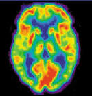 File:NIH PET .JPG - Wikipedia, the free encyclopedia