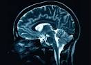 Brain Scan replaces Job Interview in 5 years? « NextNature.