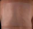 Kelo-cote Scar Healing &amp; Reduction Gel 20g (0.7oz) - Buy 1 Get one ...