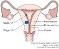 Womb