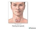 Hyperparathyroidism: UCLA Endocrine Surgery Encyclopedia