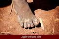 ABOUT JIGGERS