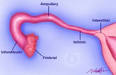 Fallopian Tube Anatomy and Functions