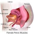 Chronic <b>Pelvic Pain</b> In Women