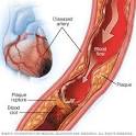 ischemia pronunciation