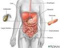 Comorbid Conditions - COPD and Comorbid Conditions