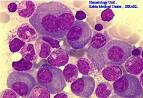 <b>Plasma cells</b>
