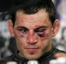 Jon Fitch Injured