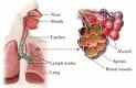 Another form of <b>aspergillosis</b>