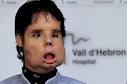 Nursing Articles: Spanish FACE TRANSPLANT Patient Leaves Hospital
