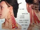 前斜角肌综合症、解剖学习-