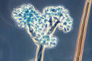 Botrytis cinerea