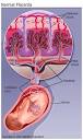 On one side of the <b>placenta</b>,