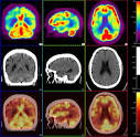 Neurological disorders - Medicalook
