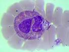 polynucléaire <b>éosinophile</b>