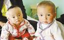 babies with kidney stones