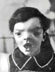 Шокирующая правда про Аватар, или Истинный диагноз На'Ви 