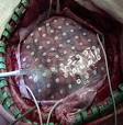 http://cdn.medgadget.com/img/bci%25202.jpg