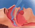 Severe Sleep Apnea | Sleep Disorders Advice &amp; Help