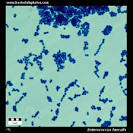<b>Enterococcus faecalis</b>
