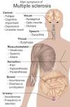 of multiple <b>sclerosis</b>.svg
