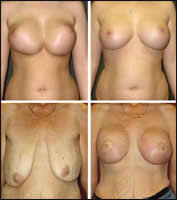 http://t2.gstatic.com/images?q=tbn:ANd9GcS1Kf2ZlL97W3XsWl1N3iCHtm6dWkvhrYZdexlvozjNInkghnz1