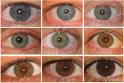 Eye Color Explained | Genes &amp; Health | DISCOVER Magazine