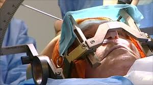 Headaches Treatment