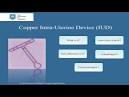 Intrauterine Device