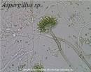 fungi <b>Aspergillus oryzae</b>