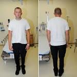 Photos Show Officer Darren Wilson After Michael Brown Shooting.