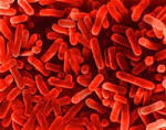 legionella <b>bacteria</b>
