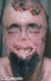 http://t2.gstatic.com/images?q=tbn:ANd9GcS5OiKlqnPir6M9a_UiBmj8pKooUbSQIxFdahIEcx0BaUcporE&t=1&usg=__-_NY7YhUfnTV2AdXaoQihoivrlQ=