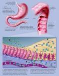 How a C.Diff Infection Is Prompted