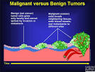 Understanding Cancer Series: Cancer - National Cancer Institute