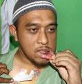 Roslan Hussain,retak tulang dagu, patah dua batang gigi, terima 20 jahitan - roslan