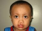 patient HAnef Abdul Samad