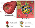 Synthetic HDL- A New Weapon to Fight Cholesterol Problems ...
