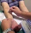 Bigfigure: Skin Testing for Allergies