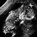 Private Ultrasound Dating Scan - Private Pregnancy Scans - Ultrasound-