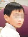 不慎將擦膠塞入鼻孔的男生送院。