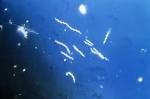 File:<b>Borrelia burgdorferi</b>