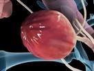 Bladder Infections