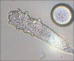 Demodex folliculorum - Wikipedia, the free encyclopedia