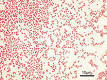 Gram-negative bacteria - Wikipedia, the free encyclopedia